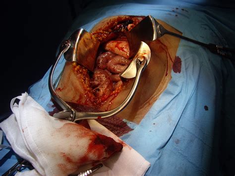 Trauma / Medical - KM Effects