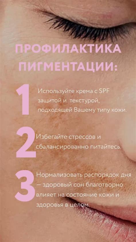 Профилактика пигментации , готовые сторис для косметолога | Косметолог ...