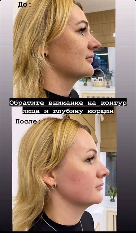 Спа процедуры для лица в Сочи