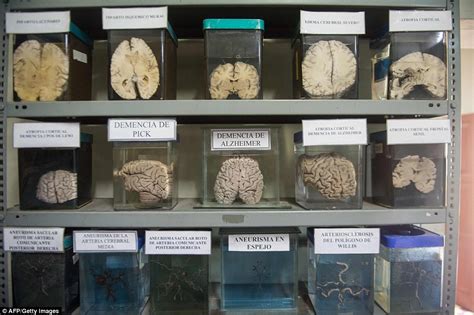 brain museum  boasts   exhibits daily mail