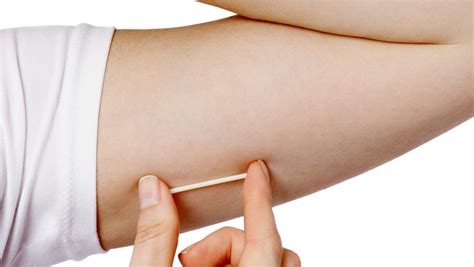 IUDs, implants generate new enthusiasm and some worries