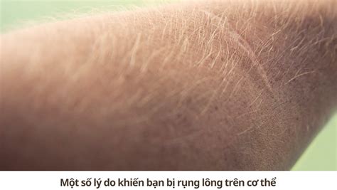 mot  ly  khien ban bi rung long tren