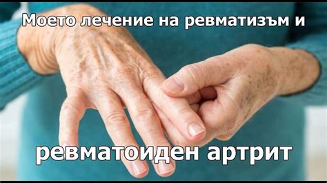 Моето #лечение на ревматизъм и #ревматоиден #артрит - YouTube