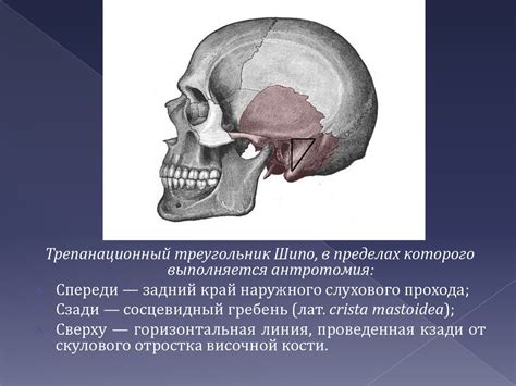 Гайморотомия. Антротомия - презентация онлайн
