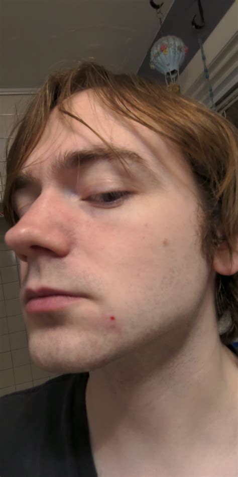 just popped a pimple and now there's a red spot that doesn't go away