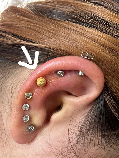 Ear (Piercing) Infection! : r/piercing