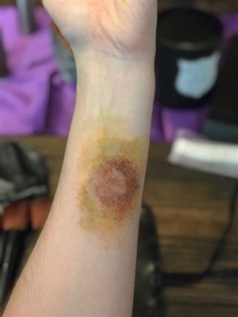 Apply Special Effects Makeup Bruises - Mugeek Vidalondon