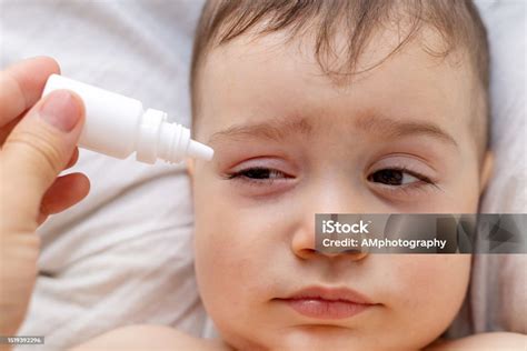 Baby Boy With Conjunctivitis Eye Drops Stock Photo - Download Image Now ...