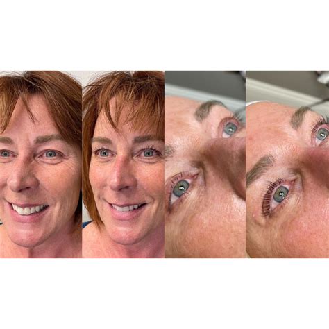 Before & After - Escape Medical PC