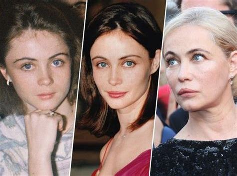 Emmanuelle Béart : chirurgie esthétique ratée
