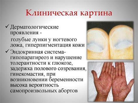 Болезнь Вильсона-Коновалова. Дифференциальный диагноз с хроническими ...