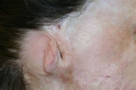 ear trauma bites burns expert advice  surgery  minor  major