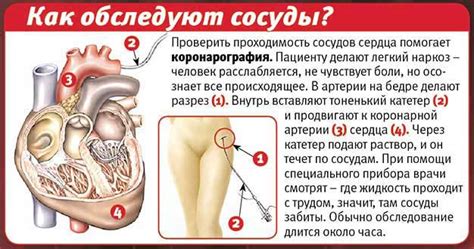 Как проводится коронарография сосудов сердца