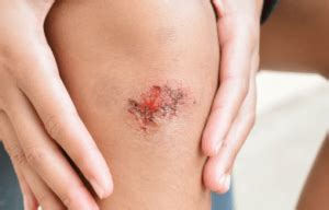 5 Simple Steps To Erase The Evidence