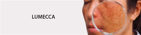 LUMECCA -SKIN REJUVENATION - Elixircosmetics