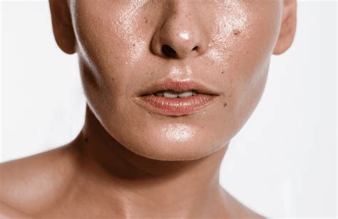 oily skin  effects treatments ensoul medical clinic