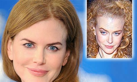 Nicole Kidman admits to having used Botox after years of questions ...