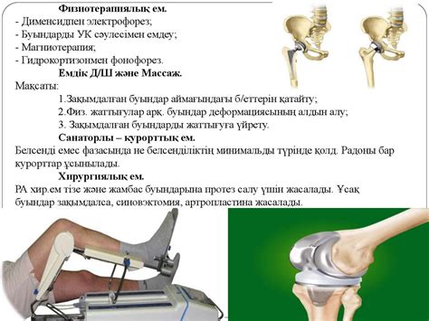 Ревматоидты артрит - презентация онлайн