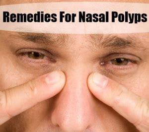 Remedies and Treatments for Nasal Polyps | Nasal polyps Blog