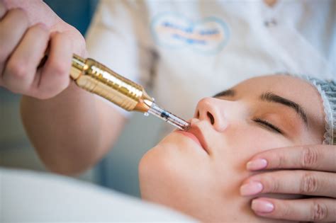 Hyaluron Pen - Beauty & Body