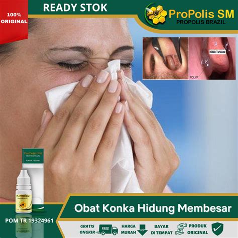 Obat Konka Hidung Membesar, Obat Pembengkakan Konka Hidung, Obat Konka ...