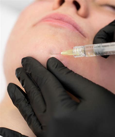 Muscle Relaxant Treatments | Boost Aesthetics Omokoroa