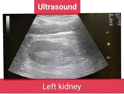Portable ultrasound in Urology - Urology Clinic in Malaysia