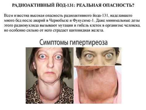 Радиоактивный Йод-131 и его влияние на организм человека - презентация ...