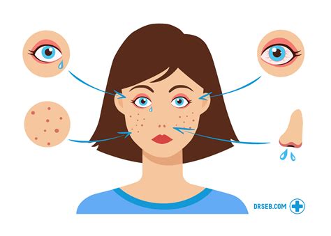 Oversigt over de mest omfattende allergier i Danmark | Dr Seb