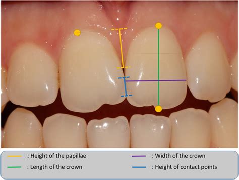 Illustration of the different clinical measurements performed ...