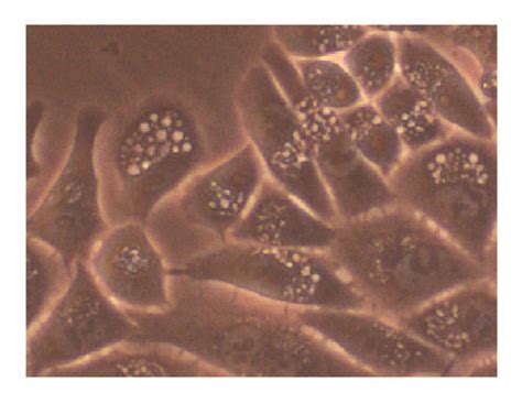 TSG inhibited growth of HepG2 cells. (a) The HepG2 cells were treated ...