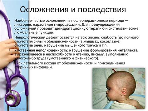 Врожденные черепно - мозговые грыжи - online presentation
