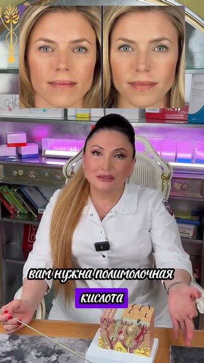 Филлеры или полимолочная кислота? #косметология #филлеры #полимолочка # ...