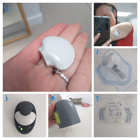 medtronic guardian  sensor review