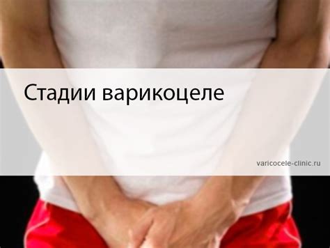 Стадии варикоцеле / Клиника лечения варикоцеле №1