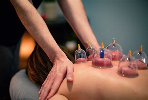 Discover the Secret Healing Power of Cupping Therapy! You Won’t Believe
