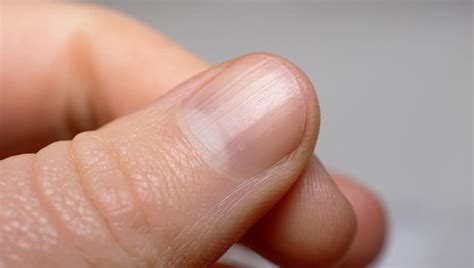 Afinal, as unhas precisam 'respirar' entre uma esmaltação e outra?