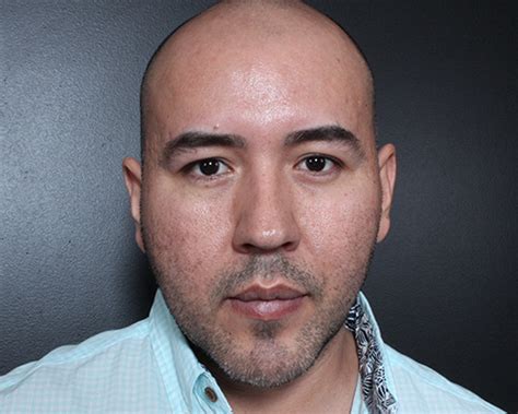 chin  cheek     plastic surgery photo gallery