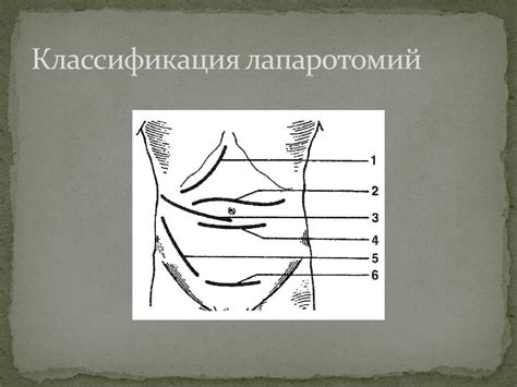 Операции на передней брюшной стенке. Грыжи и герниопластика ...