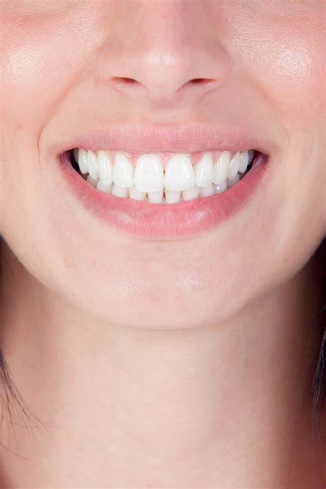 Healthy Smile