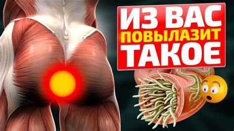 Очень мощное средство от паразитов! Всего 2 ложки этой смеси и вылетят ...