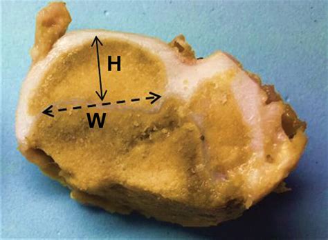 description   height  width   epiphysis  epiphyseal