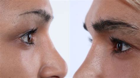 Before And After: How Vegamour Helped Grow My Eyebrows Naturally ...