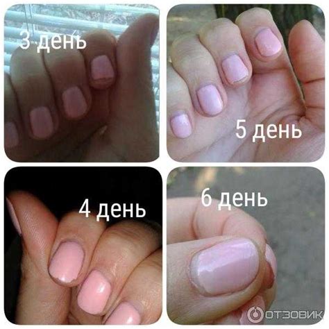 Что делать если под гель лаком треснул ноготь