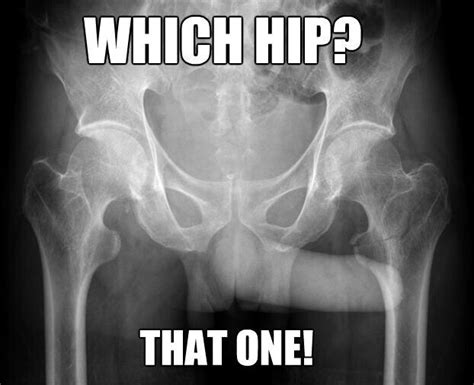 The 25+ best Radiology Humor ideas on Pinterest