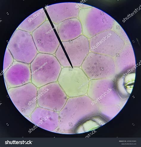 Epidermal Cells Rhoeo Images: Browse 13 Stock Photos & Vectors Free ...