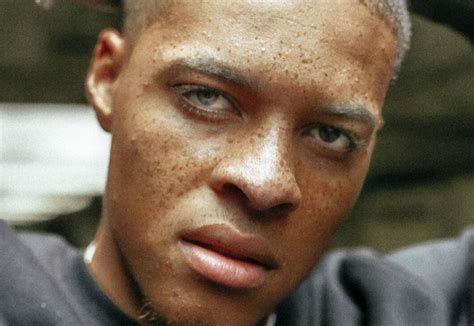 black people  freckles  heres  history  freckles
