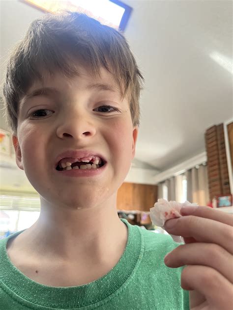 Life from A to T: Lost teeth and Lego day