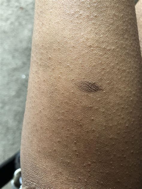 Hi, I need guidance. Is this how dry skin looks like? I googled it, but