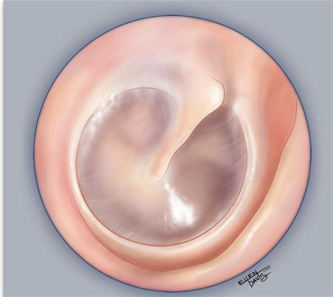 Tympanic Membrane Study Terms & Definitions in Biology Flashcards | Quizlet